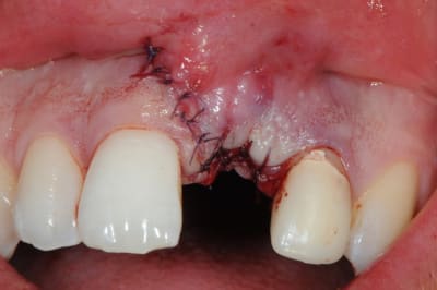 Dsc 5979 cxlvom - Eugenol