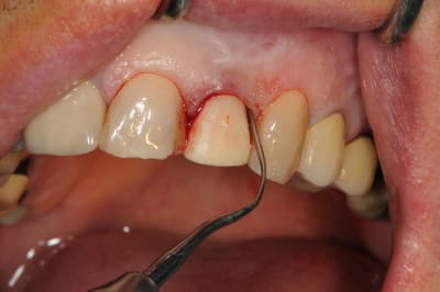 Dsc 5985 h1n3tn - Eugenol