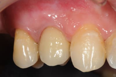 Dsc 6159 dzl2hw - Eugenol