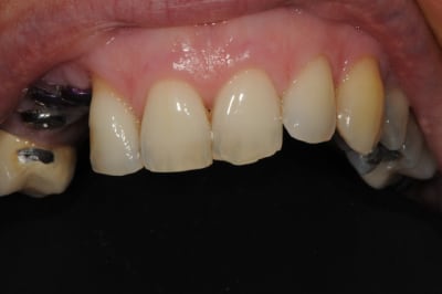 Dsc 6178 v1x1or - Eugenol