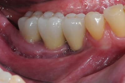 Dsc 6180 oynrin - Eugenol