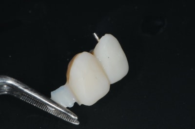 Dsc 6221 ipdngw - Eugenol