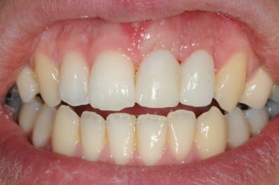 Dsc 6222 rhwmat - Eugenol