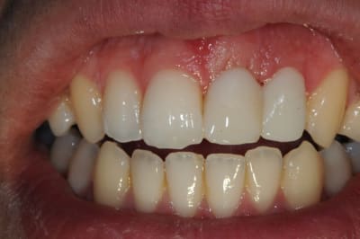 Dsc 6223 ooxuut - Eugenol