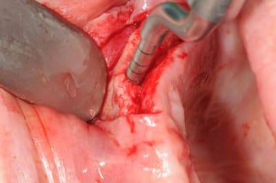 Dsc 6326 vrzm0f - Eugenol