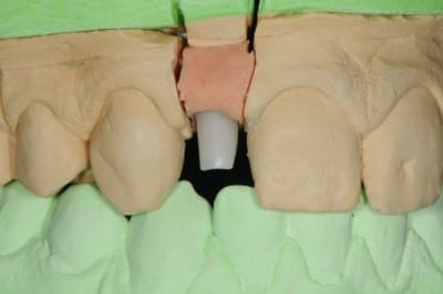 Dsc 6408 lx3kne - Eugenol