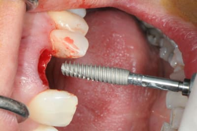 Dsc 6481 eb8jgh - Eugenol