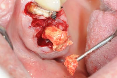 Dsc 6752 asd2xk - Eugenol