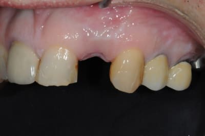 Dsc 6995 s2dii1 - Eugenol