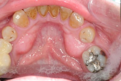 Dsc 6998 gm4fkz - Eugenol