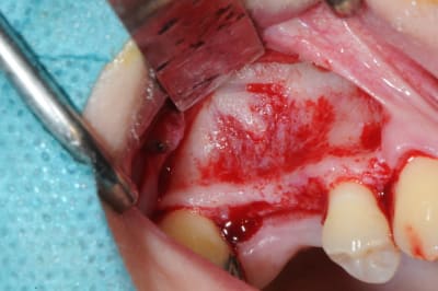 Dsc 7175 hwjius - Eugenol