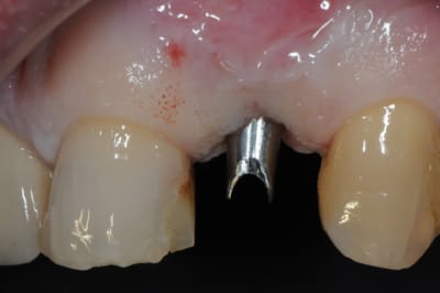 Dsc 7341 efymmf - Eugenol