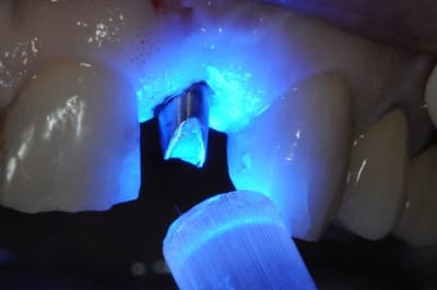 Dsc 7342 ch3sap - Eugenol