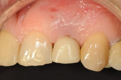 Dsc 7563 bdoakz - Eugenol