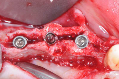 Dsc 7722 axr48z - Eugenol