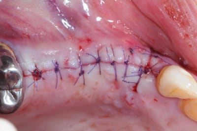 Dsc 7726 o9o9jd - Eugenol