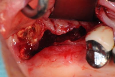 Dsc 8455 nzjzgx - Eugenol