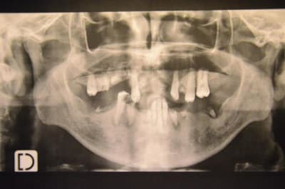 Dsc 8833 tgpwv7 - Eugenol