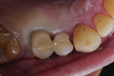 Dsc 8859 ch1ubs - Eugenol