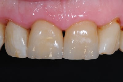 Dsc 9076 gxpycg - Eugenol