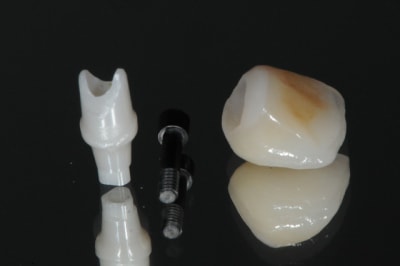 Dsc 9304 lz0dg8 - Eugenol