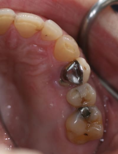 D but vue sup u4f3ym - Eugenol