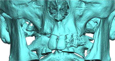 Dentascanner kuz1bl - Eugenol