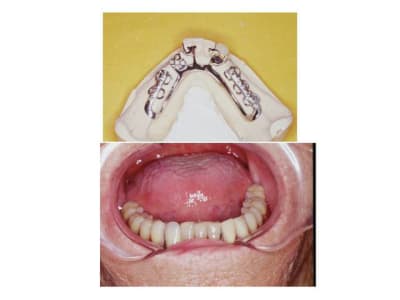 Diapositive3 ytzmxp - Eugenol