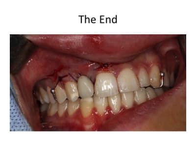 Diapositive7 ipvfbm - Eugenol