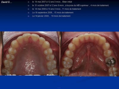 Diapositive8 wm5iq4 - Eugenol