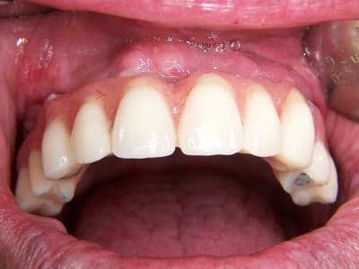 Dr j - Eugenol