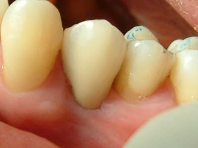 Dscf0001 lmv3hw - Eugenol