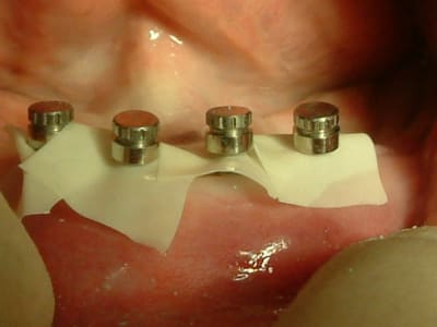 Dscf0012 n0ctfn - Eugenol