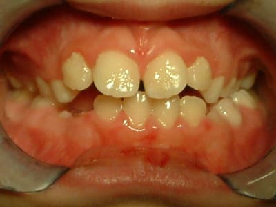 Dscf0023 fzef2z - Eugenol