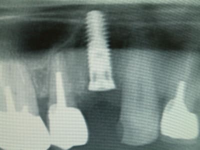 Dscf0029 ptudjj - Eugenol