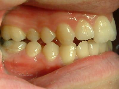 Dscf0030 rtmfzp - Eugenol