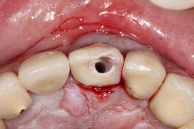 Eii mci  6  ysoicl - Eugenol