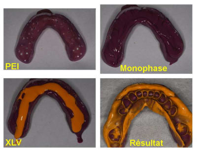 Empreinte  mono xlv  zxwivz - Eugenol