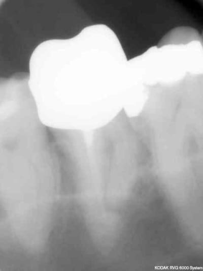 Endo3 frh2mx - Eugenol