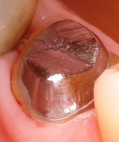 F72fdf5d 63f0 4e81 b4a5 7e4f4fe792a1 zs9vbh - Eugenol