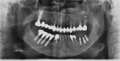 Fa jo h2emdn - Eugenol