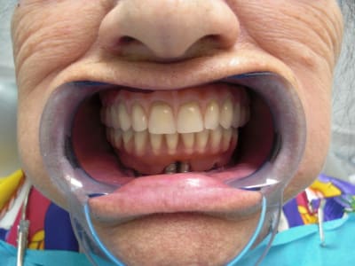 Fin1 pmoxk0 - Eugenol