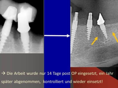 Folie5 ybpq9g - Eugenol