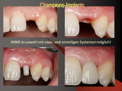 Folie7 i0c3wq - Eugenol