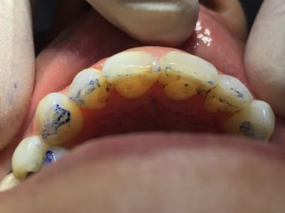 Fullsizerender 1  xkgg3s - Eugenol