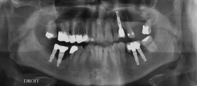 Gagj pi24.04 - Eugenol