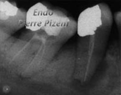 Go 44avant dayidf - Eugenol