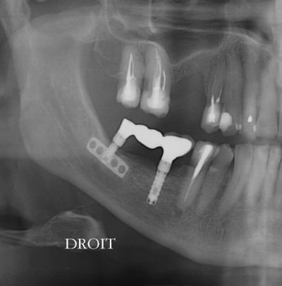 Gri fra14.03 - Eugenol