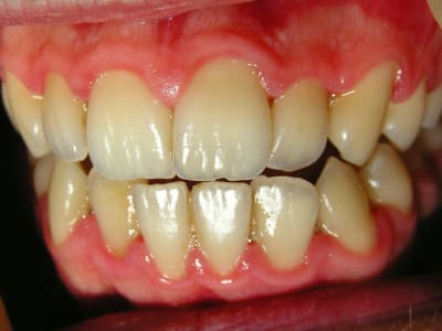 Gun j 9 r6q6jy - Eugenol