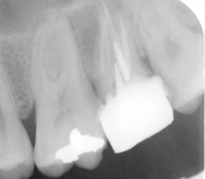 Hd130826140028 m6taor - Eugenol